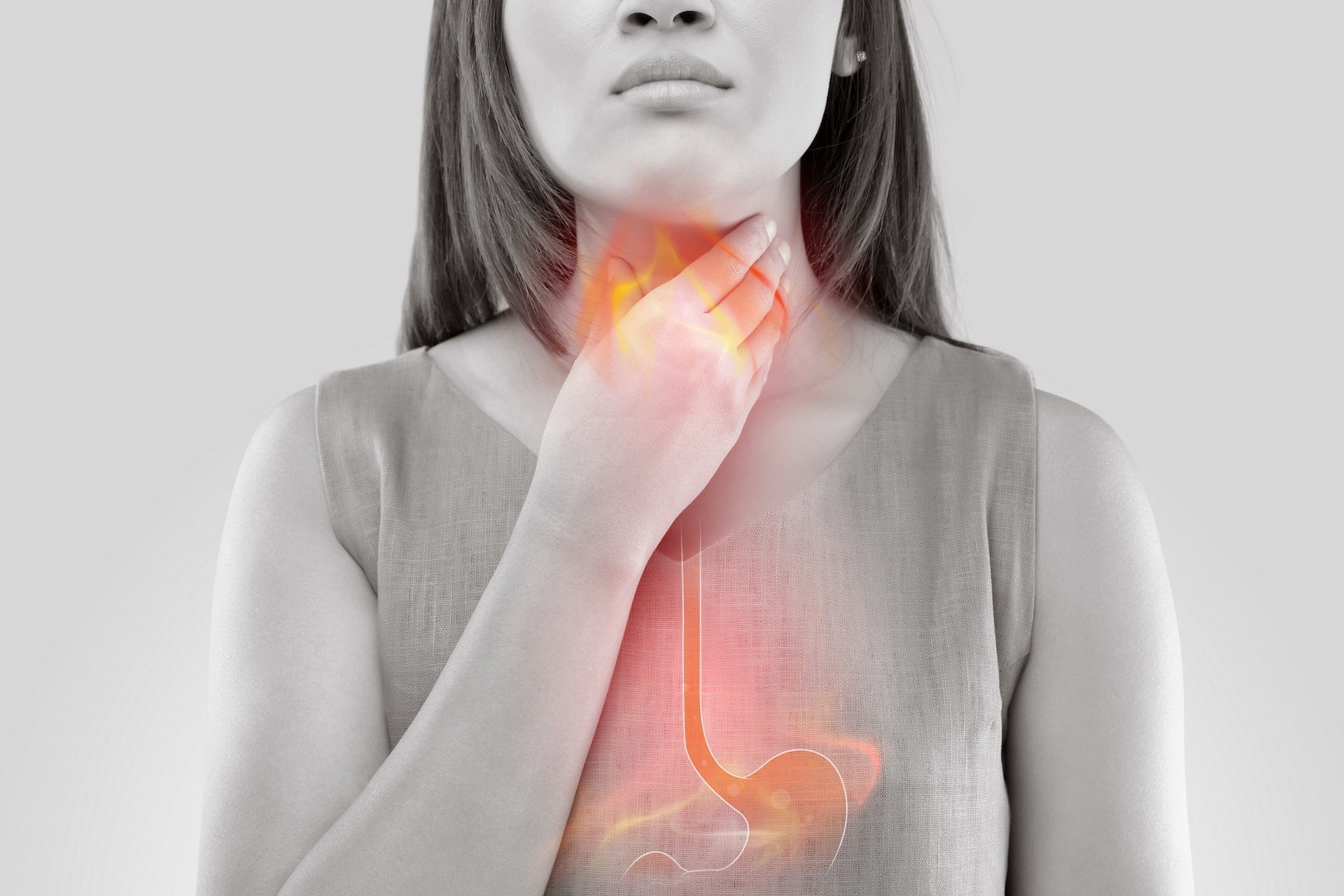 Apple Cider Vinegar for Acid Reflux